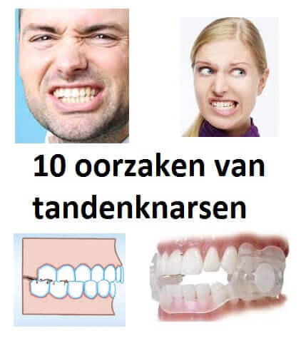 10 Oorzaken Van Tandenknarsen Uitgelicht -